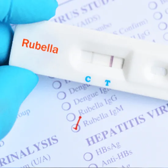 Rubeola (Measles) IgM Test